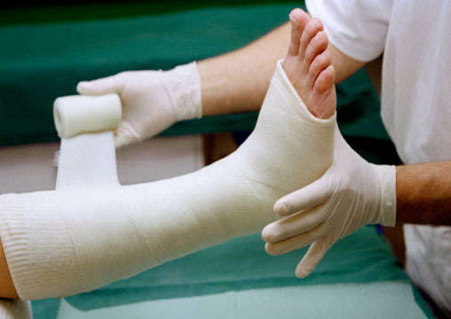 fracture